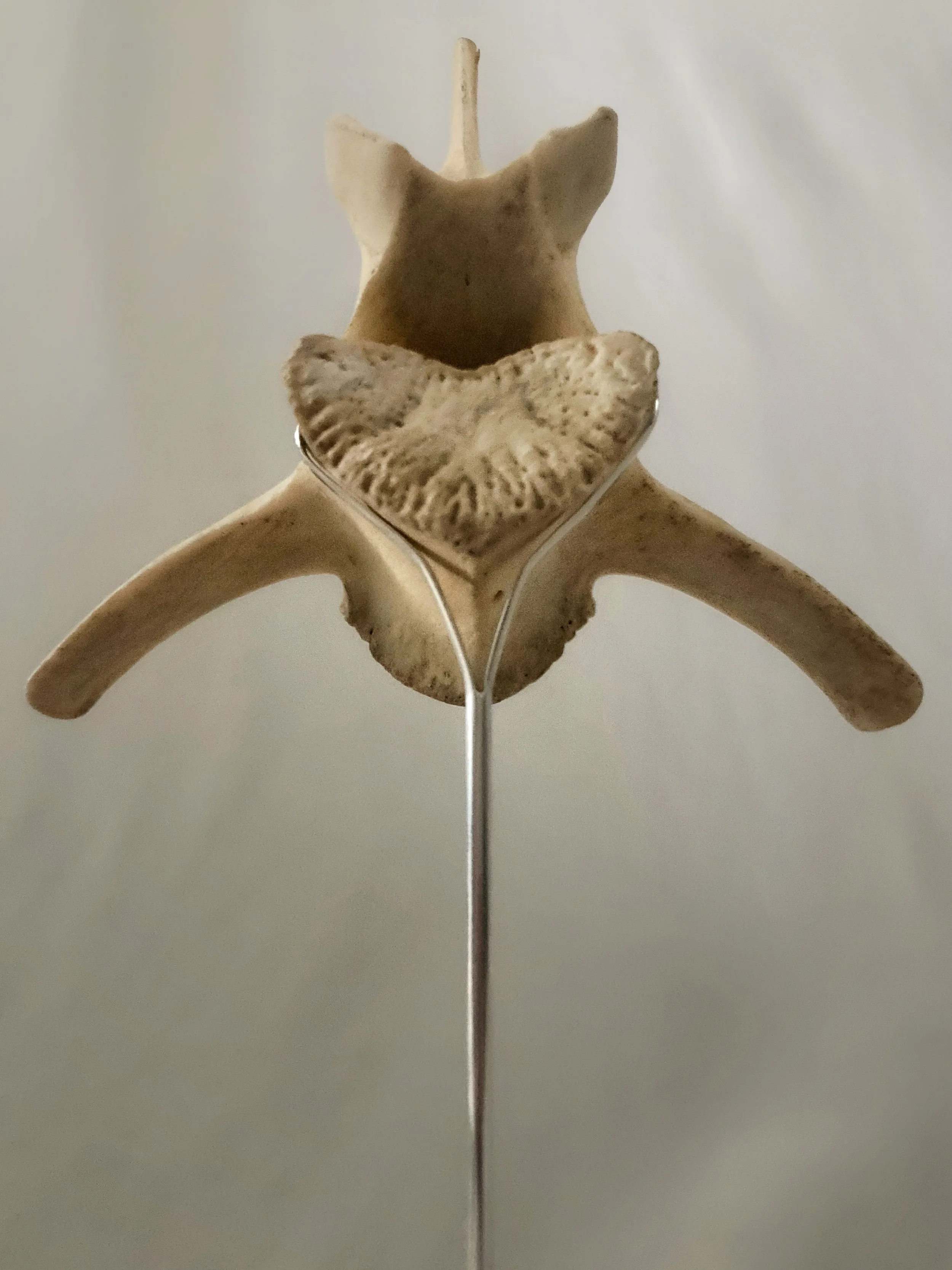 Close-up anatomical model of the sacrum and lumbar spine with pelvic bones