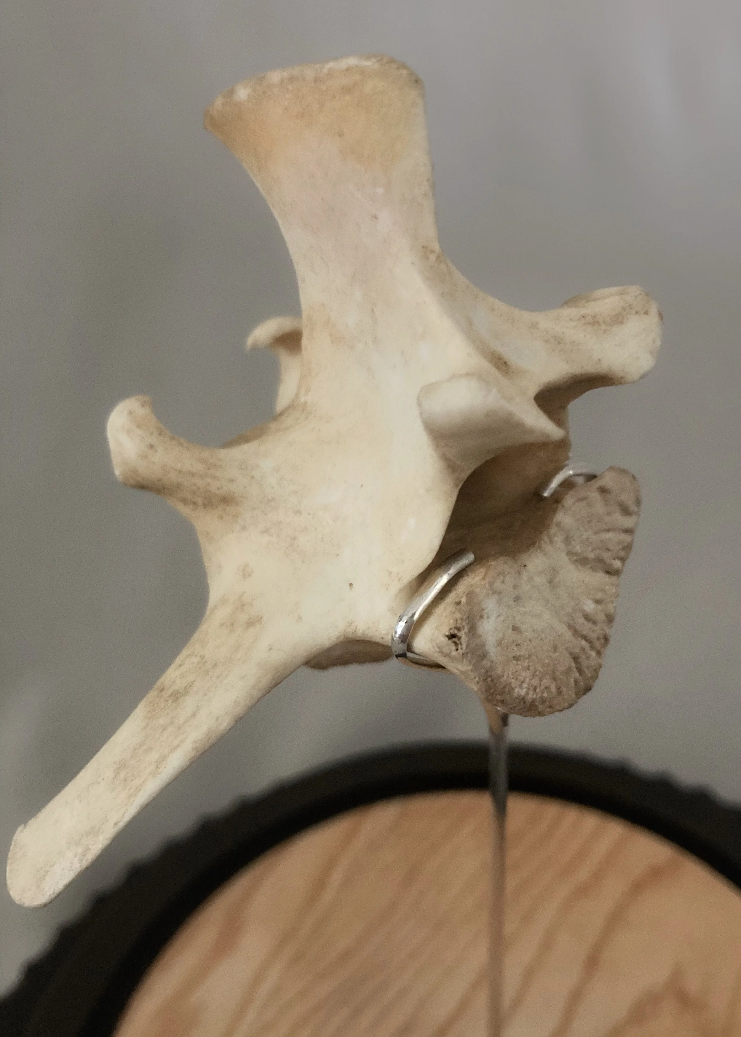 Close-up of a human cervical vertebra with metal surgical hardware on a spine model.