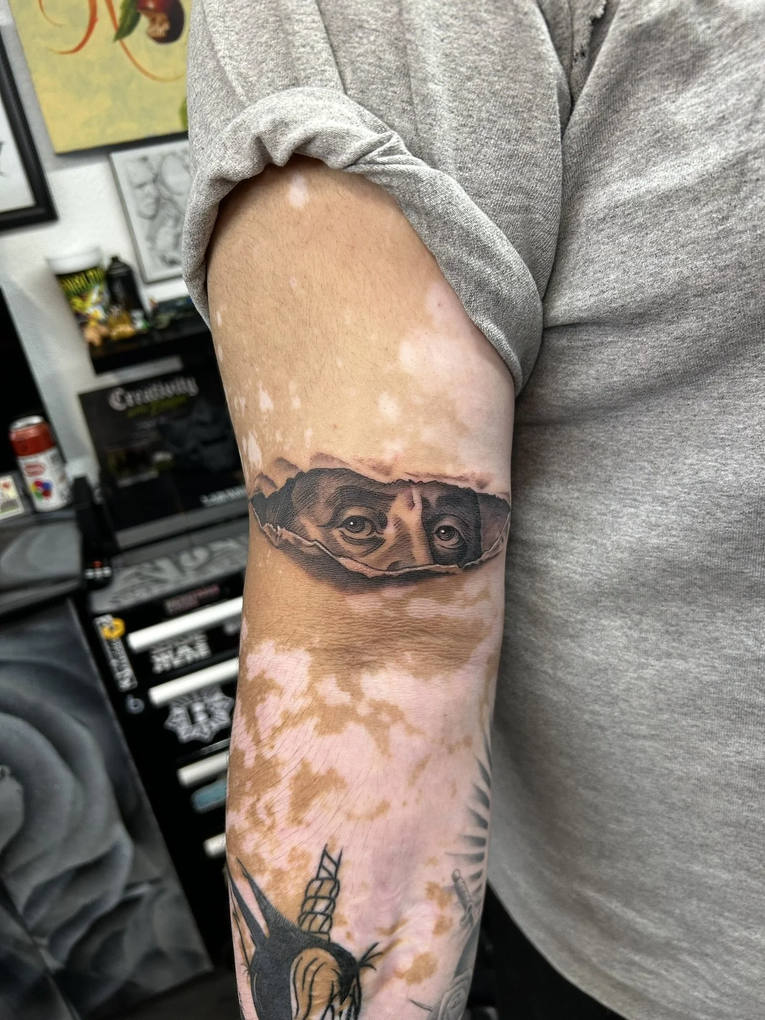 Close-up of a tattooed arm featuring a black-and-gray portrait band tattoo and patchy lighter skin pigmentation.