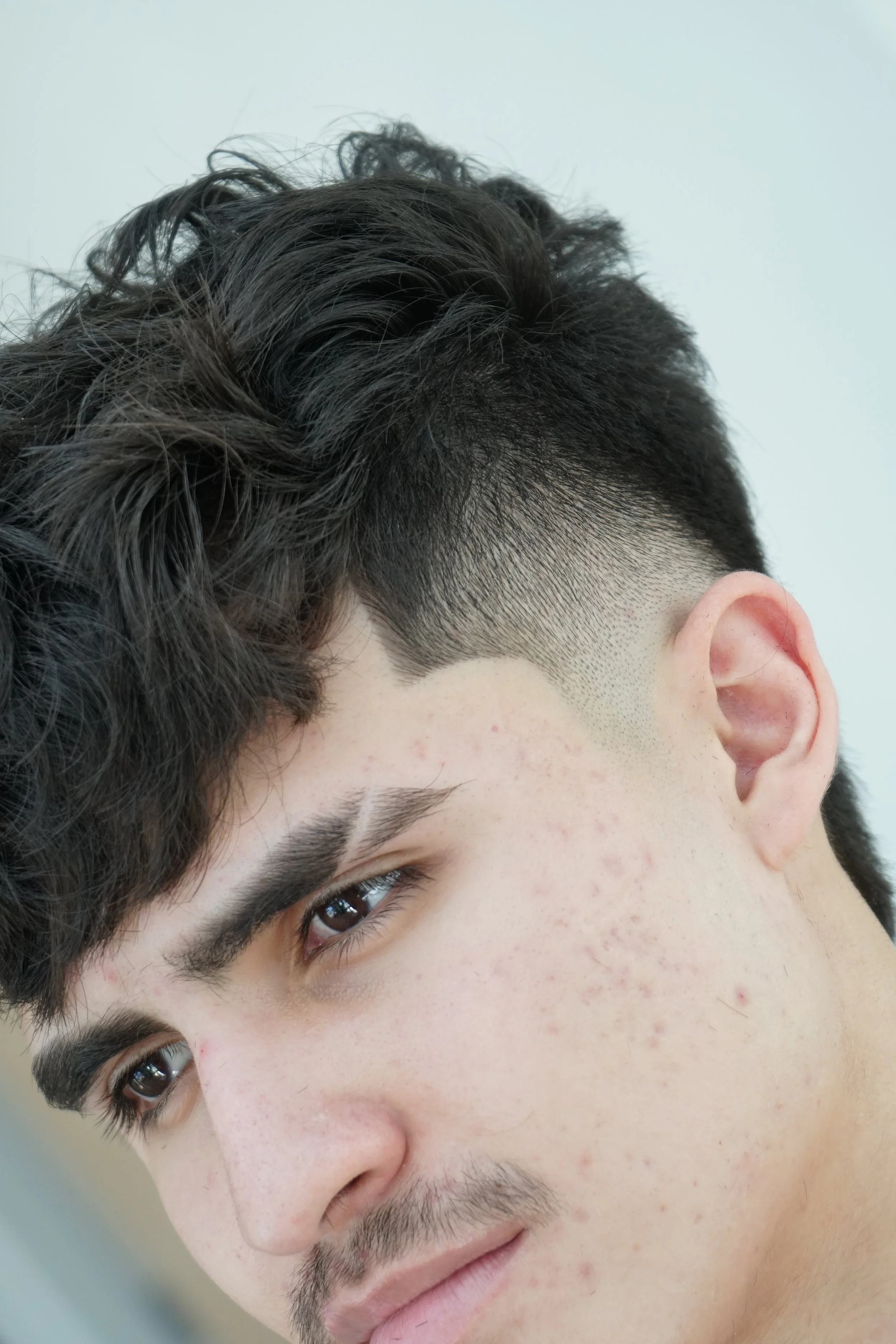 Close-up portrait of a man with dark curly hair, brown eyes, light facial hair, and visible acne.