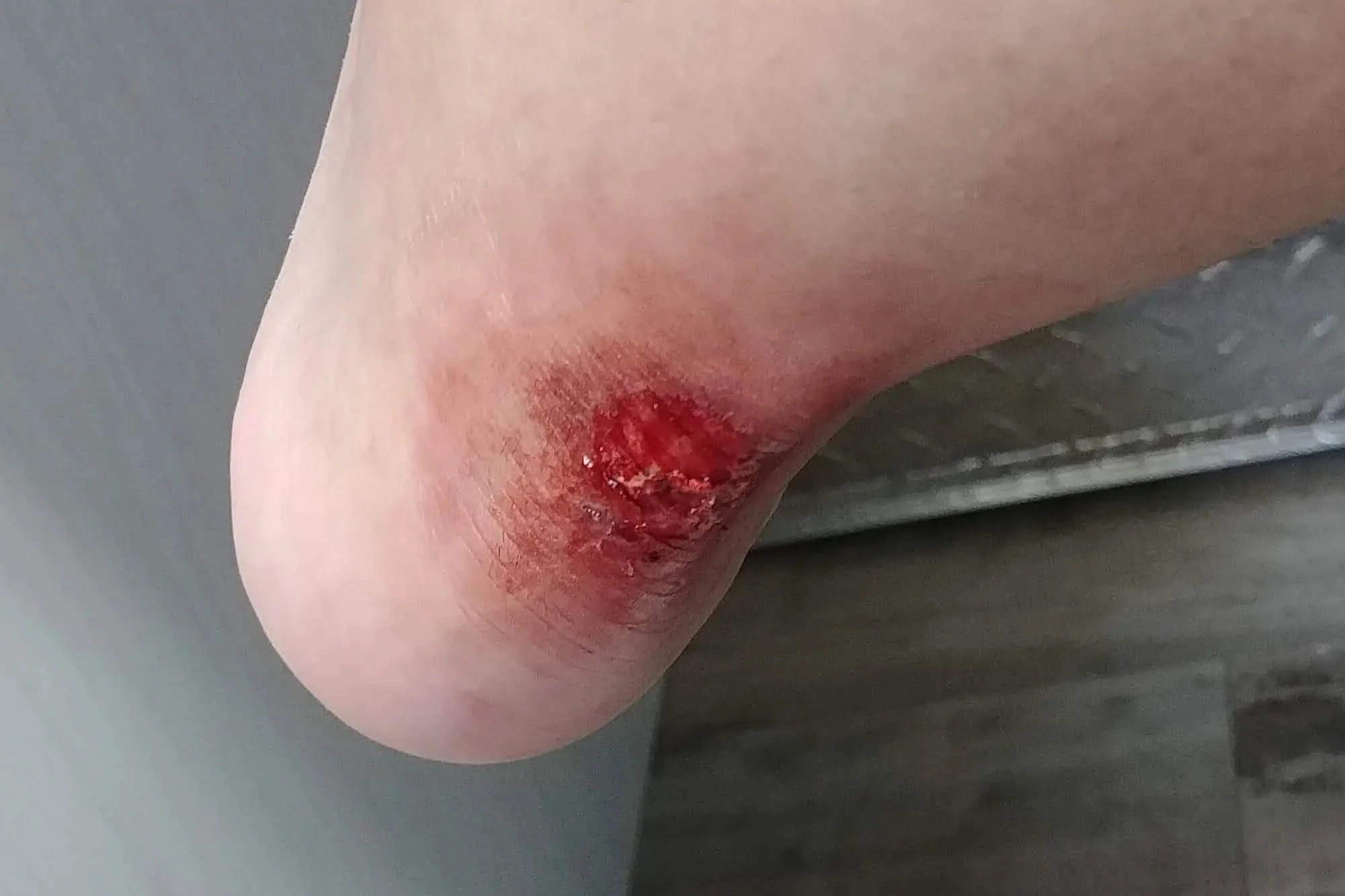 20190607_155738.jpg