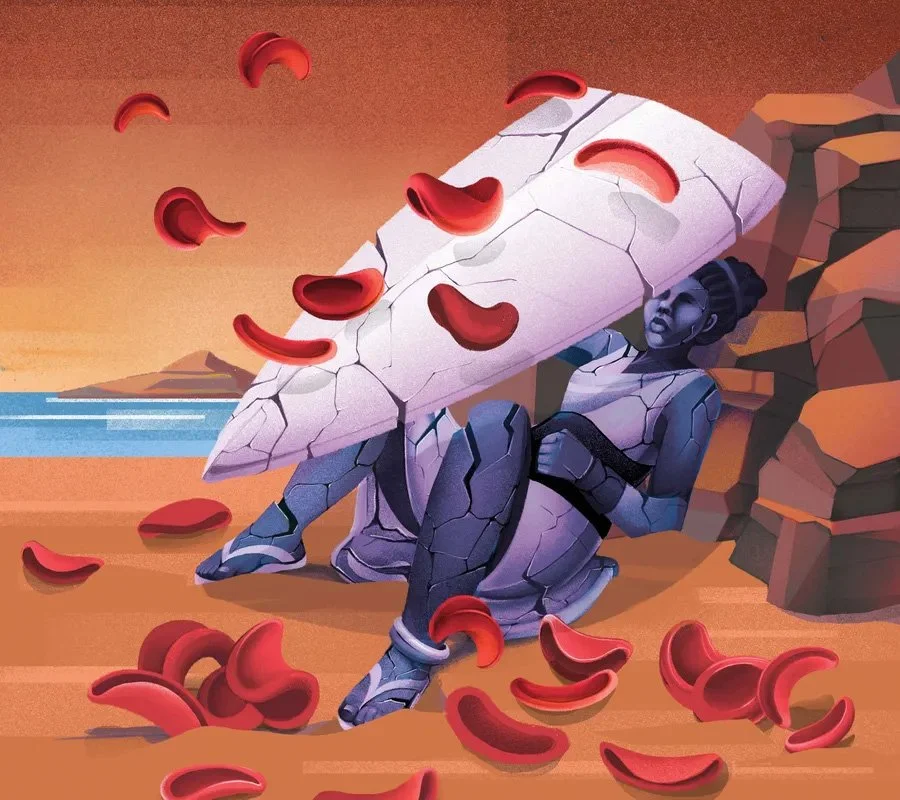 Scientific American: Researchers Seek New Solutions To Ease Sickle Cell’s Extreme Pain