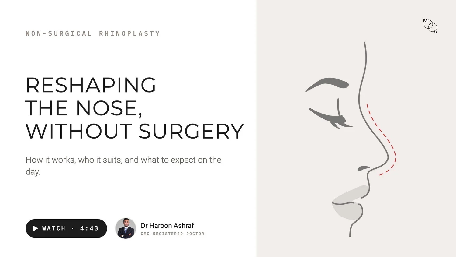 Video poster: reshaping the nose without surgery, explained by Dr Haroon Ashraf