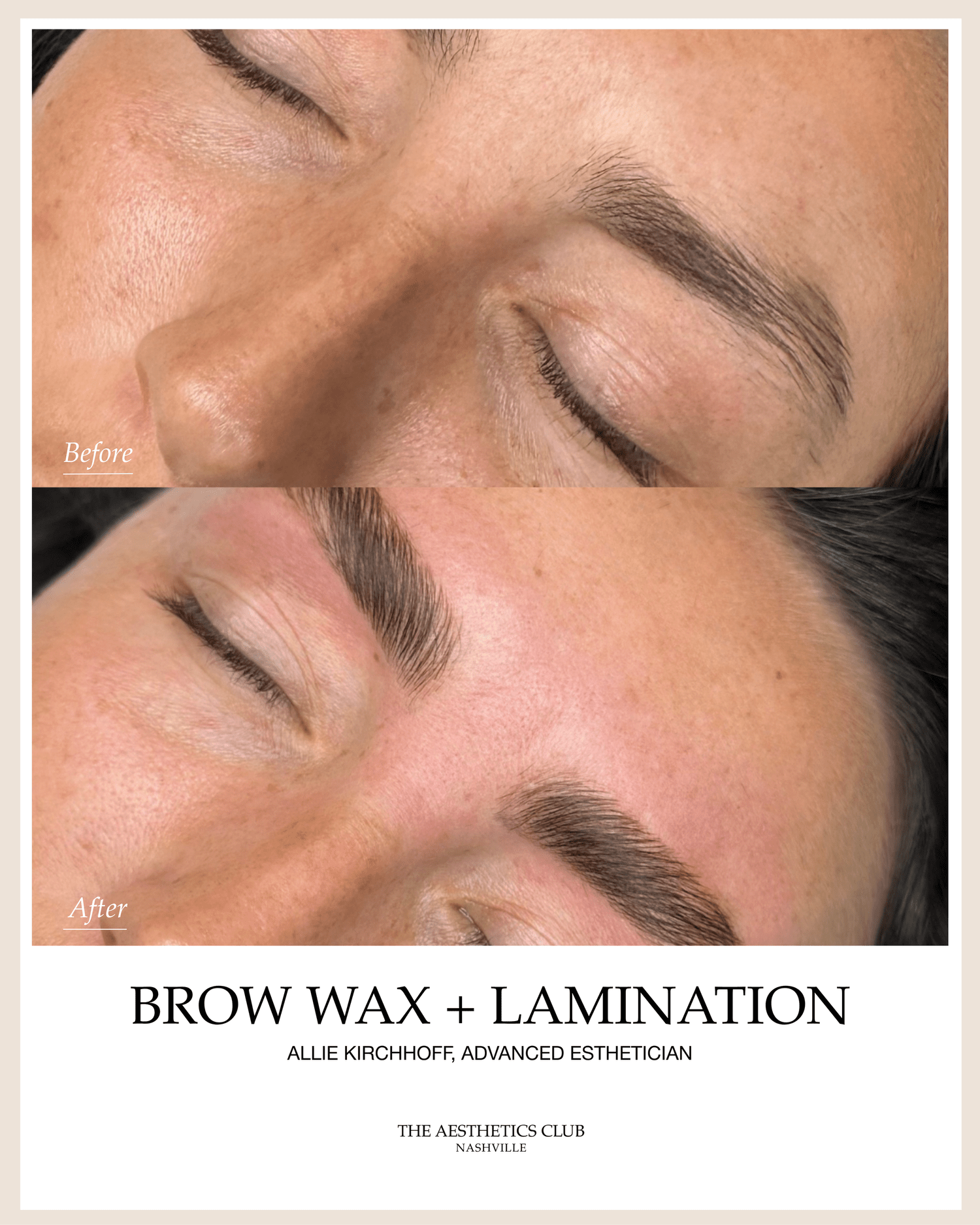 Before and after brow lamination in Nashville
