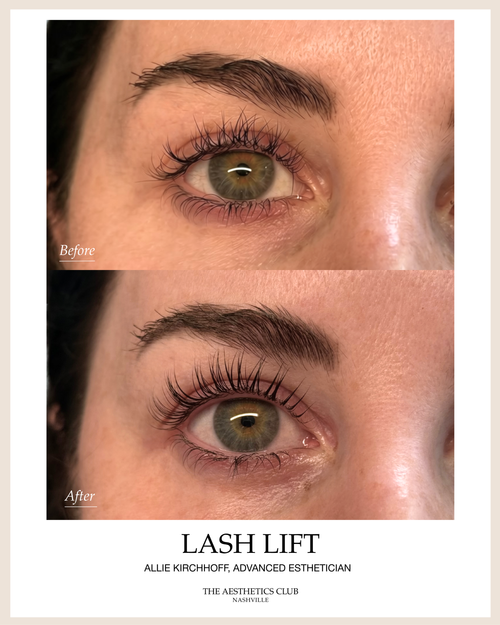 Before and after lash lift in Nashville