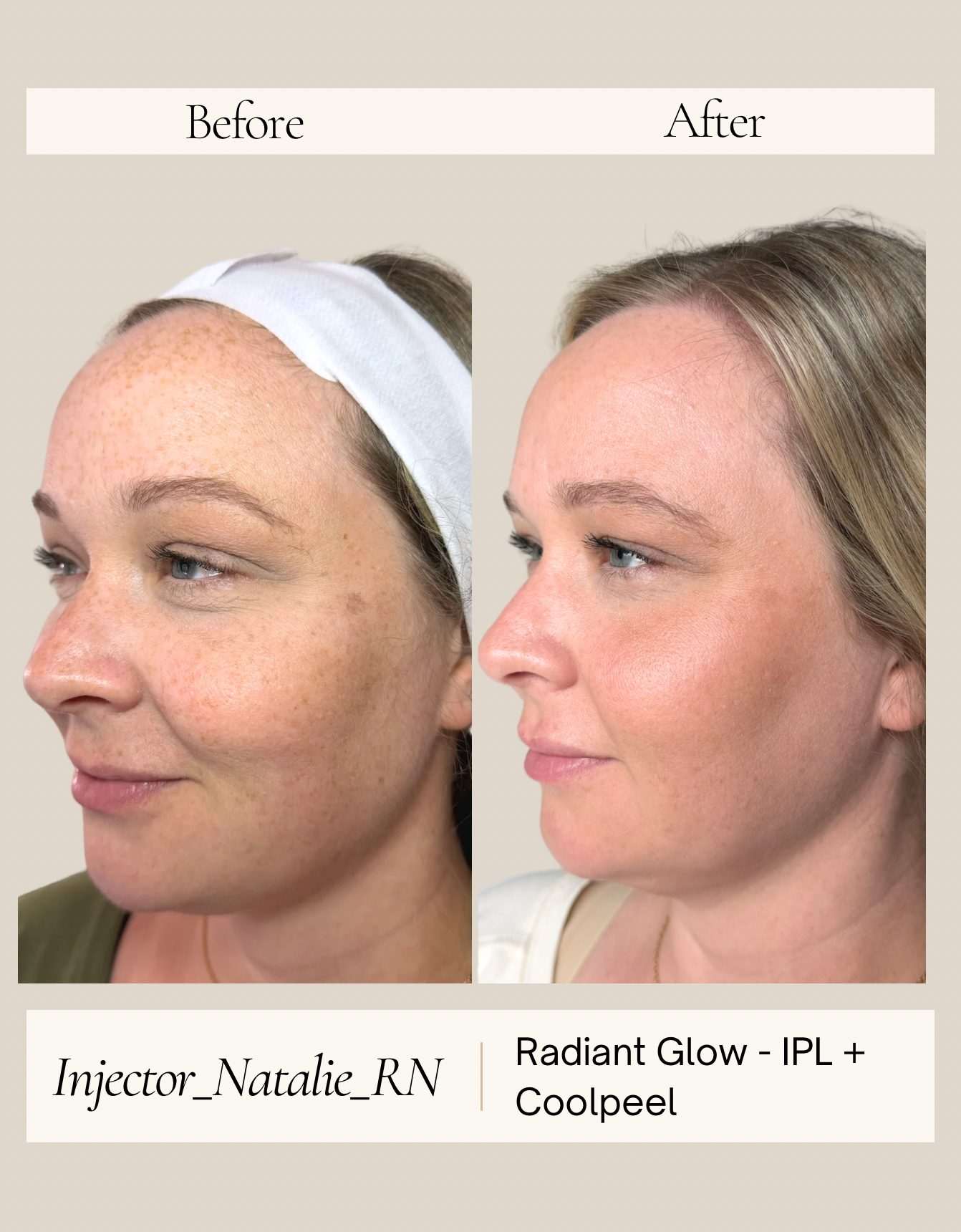 Radiant Glow by Natalie before and after